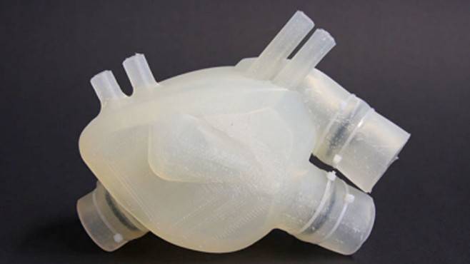 Durchbruch: Funktionierendes Herz aus dem 3D-Drucker